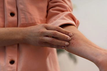 Ticks: The tiny pests with big health risks