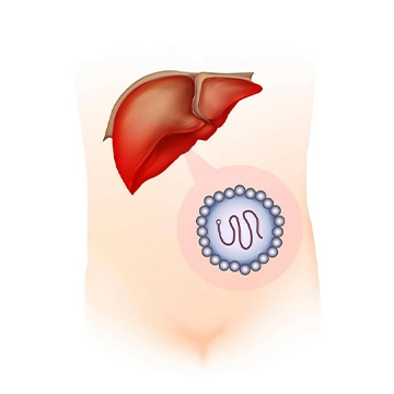 hepatitis-e