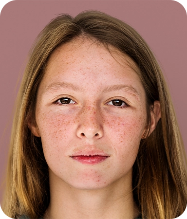 Woman examining facial acne in the mirror, considering treatment options for clearer skin.